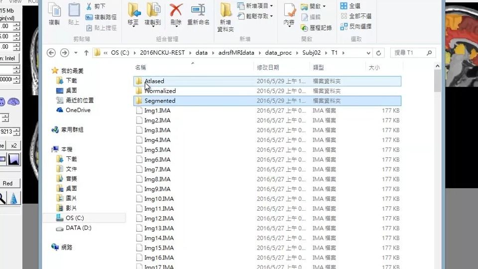 09.进阶rsfMRI分析]Part5_6 Seed-based功能连接